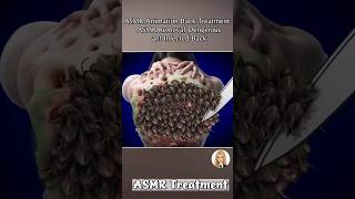 ASMR learning Animation Trick Video Treatment Head back Side [upl. by Perlis834]