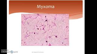 HYALINE CHANGE AND MUCOID CHANGE [upl. by Tansey]