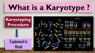 Karyotype  What is a Karyotype and how is it done [upl. by Ellah]