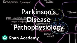 Putting it all together  Pathophysiology of Parkinsons disease  NCLEXRN  Khan Academy [upl. by Burkle]