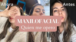 Maxilofacial quien me operó donde [upl. by Arenat]