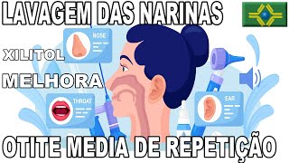 OTITE MÉDIA DE REPETIÇÃO  Lavar as narinas com XILITOL diminui as crises [upl. by Bart200]