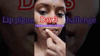 💯 Solution for dark lips lipcareproducts lipcaretips lipcare lipcare lipcareroutine lips lip [upl. by Annaes]