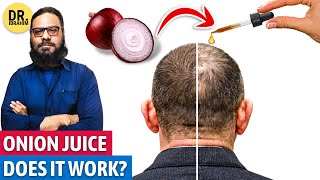 quotPYAZ KE JUICEquot Se Hair Growth Onion Juice For Hair Regrowth  Dr Ibrahim [upl. by Acinot]