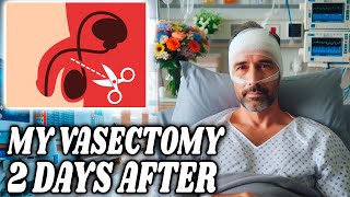 MY VASECTOMY SURGERY  2 DAYS AFTER [upl. by Cherry665]