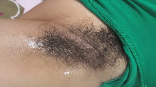 Underarm Long Hair Waxing PART3 [upl. by Ayrotal]