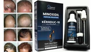 MINOXIDIL TOPICAL SOLUTION KERADOC 10 SOLUTION SPRAY [upl. by Enohs]