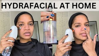 hydrafacial at home  before and after treatment [upl. by Einhpad730]