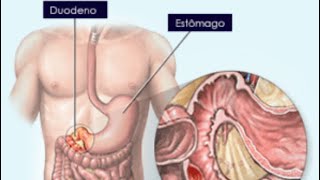 Problemas no Esôfago Estômago e Intestino Ritual gratuito Corrente Mediúnica [upl. by Bentlee]