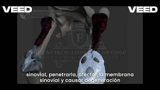 Patología del Sistema Osteoarticular  Parte 2 Inflamación Nomenclatura y Vías de Acceso [upl. by Bate]