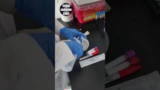 🩸Tutorial💉Te Enseño Facil y Rapido a Como Tomar una Muestra de Sangre Venosa con Jeringa P1 [upl. by Otrebogad]