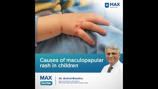 Causes of maculopapular rash in children  Dr Arvind Bountra  Max Hospital Saket [upl. by Ewens885]