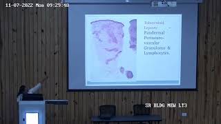 Pathology and Pathogenesis of Leprosy Dr Priyanka Agarwal [upl. by Sura]