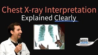 Chest XRay Interpretation Explained Clearly  How to read a CXR [upl. by Laniger]