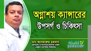 অগ্নাশয় ক্যান্সারের লক্ষণ ও চিকিৎসা  Pancreatic Cancer Symptoms and Treatment  Health Tv Bangla [upl. by Redd823]