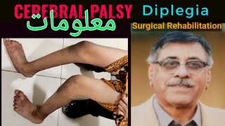 Spastic Cerbral Palsy Diplegia Detailed overview  Surgical and Rehabilitation Treatment Pathways [upl. by Oba459]