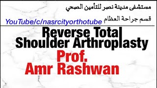 Reverse total shoulder arthroplasty ProfAmr Rashwan Nasrcity online 2020 [upl. by Sidonius]