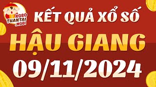 Xổ số Hậu Giang ngày 9 tháng 11  XSHG 911  KQXSHG  Kết quả xổ số kiến thiết Hậu Giang hôm nay [upl. by Corina397]