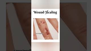 wound healing process animation।।wound healing process pathology।।3danimationshortsviralshorts [upl. by Yelra869]