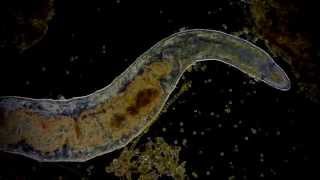 🔬 scary Annelid under microscope  Annelida  Ringelwurm  Leben in der Pfütze 1080p Full HD [upl. by Auburn]