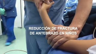 FRACTURA DE ANTEBRAZO EN EL NIÑO TRATAMIENTO QUIRURGICO [upl. by Maccarthy736]