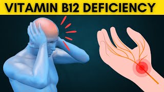 Do not ignore these symptoms of Vitamin B12 deficiency [upl. by Cirdor]