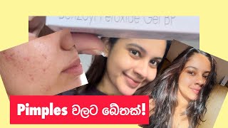 Pimples වලට මං කියනවා කිව්ව බෙහෙත [upl. by Sackey]