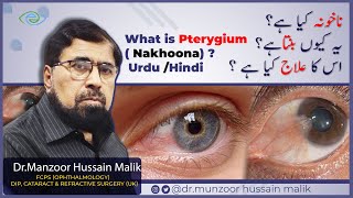 Pinguecula and Pterygium Difference  Symptoms amp Treatment in UrduHindi [upl. by Vladamir584]