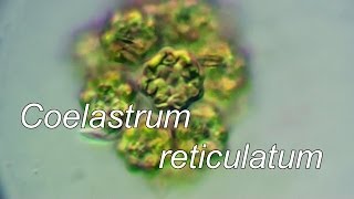 Coelastrum reticulatum [upl. by Eiramac]