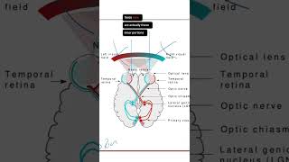 Bitemporal Hemianopia Explained neuroanatomy [upl. by Ardeahp771]