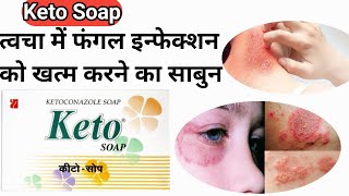 Keto Soap  कीटो साबुन के फायदे और लगाने का तरीका  Ketoconazole Soap  shorts [upl. by Mahgem]