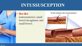 INTUSSUSCEPTION video [upl. by Ellehcil]