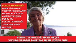 BURUN TIKANIKLIĞI NASIL GEÇER VÜCUDA VERDİĞİ TAHRİBAT NASIL ENGELLENİR [upl. by Aivuy]