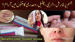 Travocort cream uses  benefits honest review by Maha jutt [upl. by Pavel]