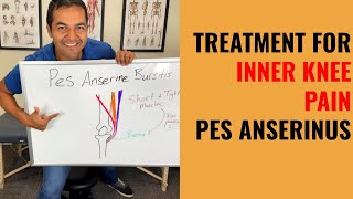 How To Cure Inner Knee Pain Caused By Pes Anserine Bursitis Easy Self Treatment That Works [upl. by Hegarty]