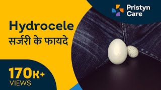 Hydrocele सर्जरी के फायदे  Hydrocele Surgery Benefits  For FREE Consultation Call On 6366528295 [upl. by Rats]