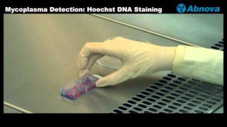 Mycoplasma Detection Hoechst DNA Staining [upl. by Eirene]