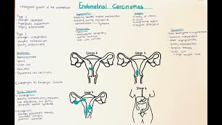 Endometrial Carcinomas  Types Diagnosis Therapy Symptoms [upl. by Kaine]