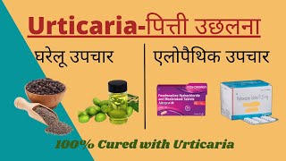 Urticariaपित्ती उछलना Allopathic treatments amp Home Remedies in Hindi II शीतपित्त का 100 इलाज I [upl. by Felic]