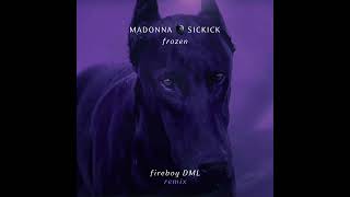 Madonna x Sickick  Frozen Fireboy DML Remix Official Audio [upl. by Acebber]