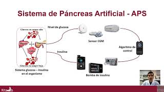 Sistema de Páncreas Artificial  APS [upl. by Novyat]