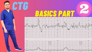 CTG Basics Part 2  CTG Monitoring in Pregnancy Fetal Cardiotocography [upl. by Manthei]