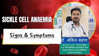 Sickle Cell Anaemia  Signs amp Symptoms  संकेत एवं लक्षण  Dr Ankit Sahay [upl. by Kylen436]