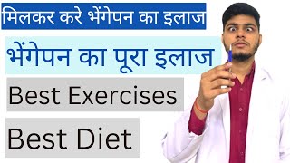 भेंगापन ठीक करने के लिए व्यायाम  Exercises and diet to Cure Squint  100 Working [upl. by Enaitsirhc337]