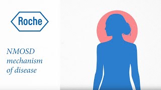 Neuromyelitis optica spectrum disorder  Mechanism of disease [upl. by Haukom]