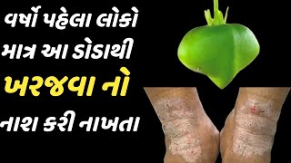 વર્ષો પહેલા લોકો માત્ર આ ડોડાથી ખરજવાનો નાશ કરી નાખતા  Eczema home made remedy [upl. by Ecinue860]