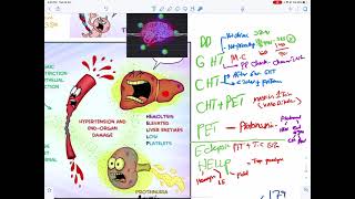 Preeclampsia شرح [upl. by Solegnave]