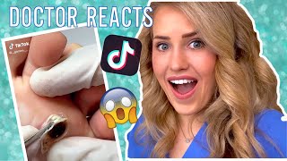 Doctor reacts to WILD foot callus TikToks [upl. by Juditha997]