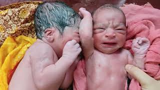 Twin babies are talking to eachother after birth with first cry😄 [upl. by Dianthe]