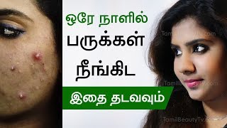 How to remove pimple  Home remedies for pimples  Beauty Tips in Tamil [upl. by Molini552]